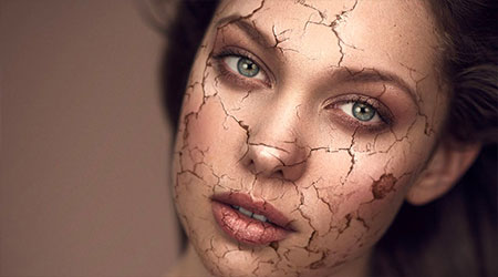 شایع ترین علت خشکی پوست چیست؟